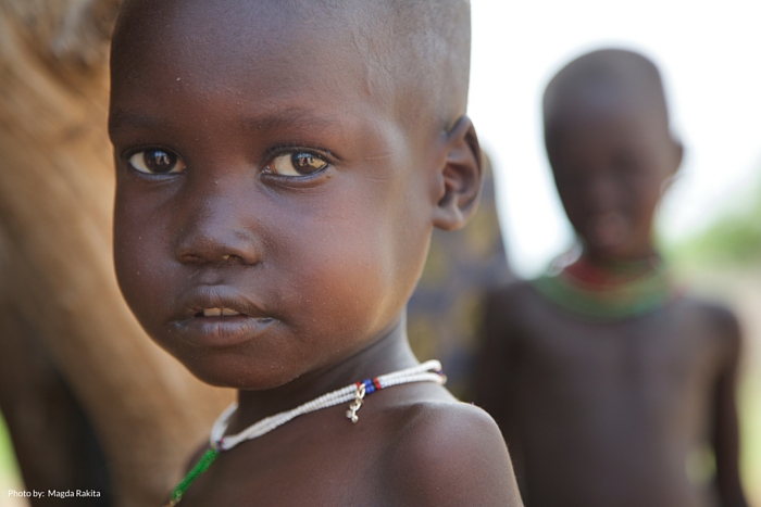 4-year-old Lopeto during a screening in his village near Naliel in Kapoeta East region.